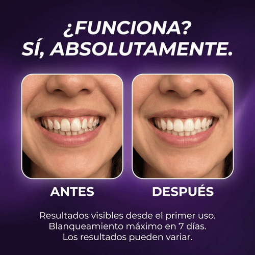 Blanqora™ Tiras Blanqueadoras Purple